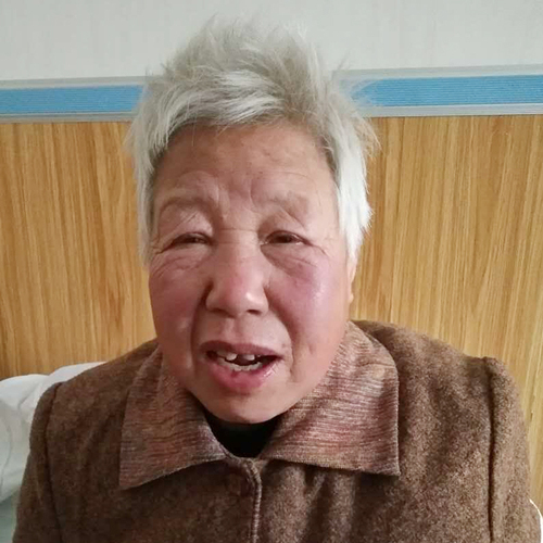 贫困患者-海伦市爱民乡爱平村的王女士